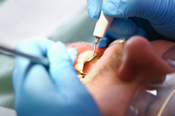Best Emergency Broken Tooth Repair in Abram, TX