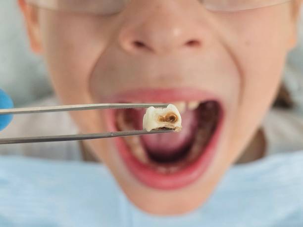 Best Emergency Treatment for Toothache in Abram, TX